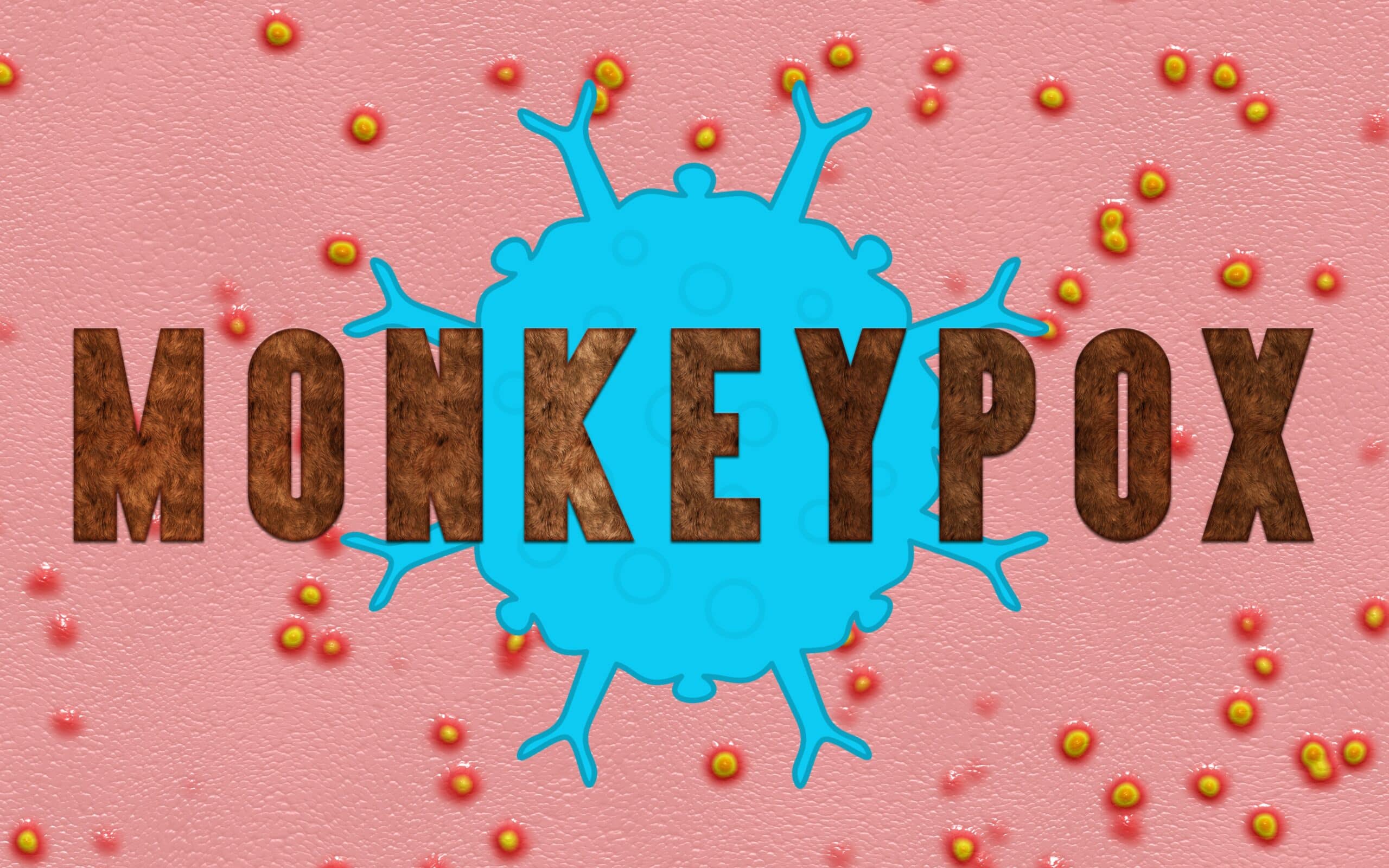 monkeypox, vaiolo delle scimmie