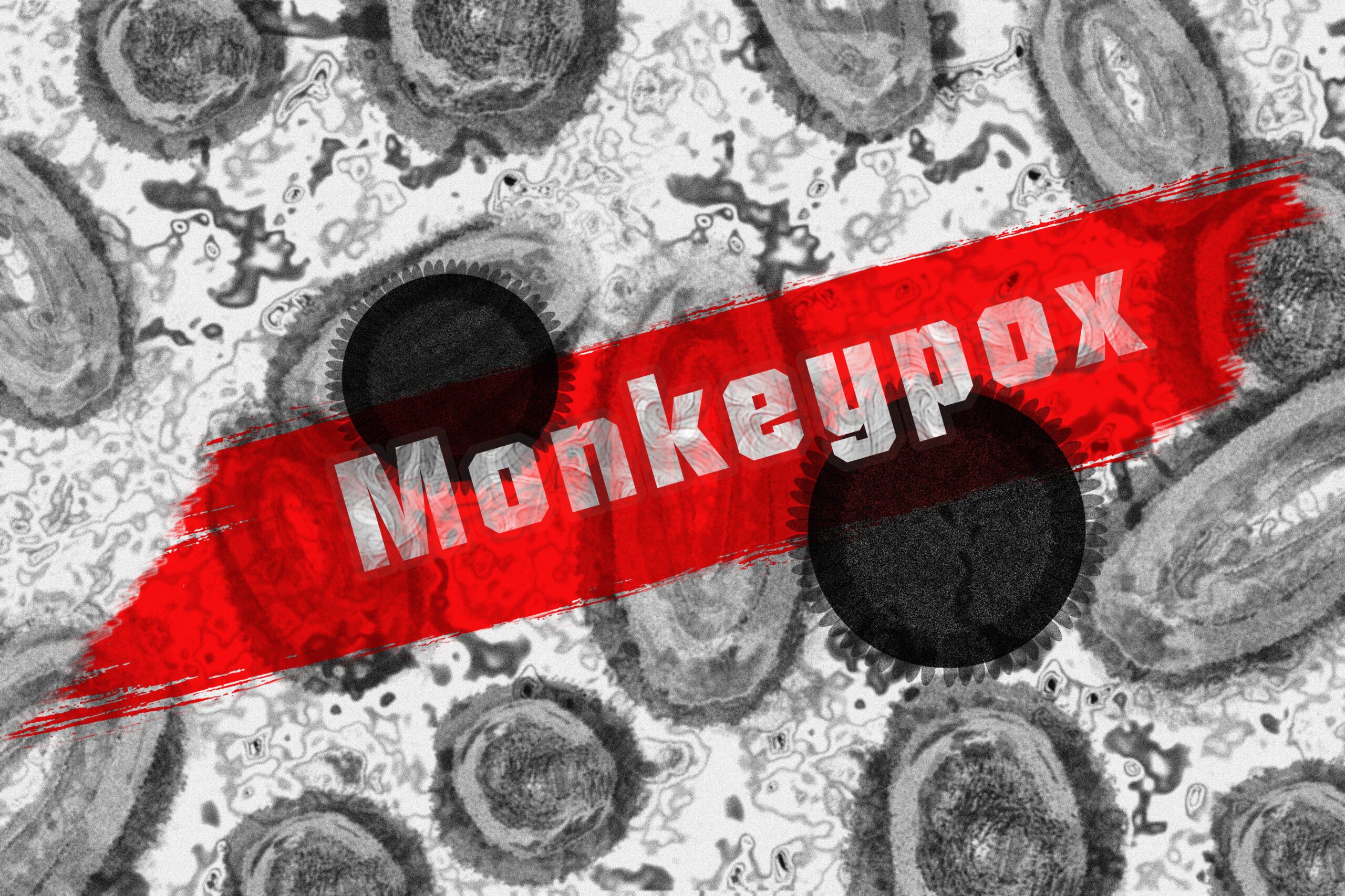monkeypox, vaiolo delle scimmie, trasmissione, diffusione